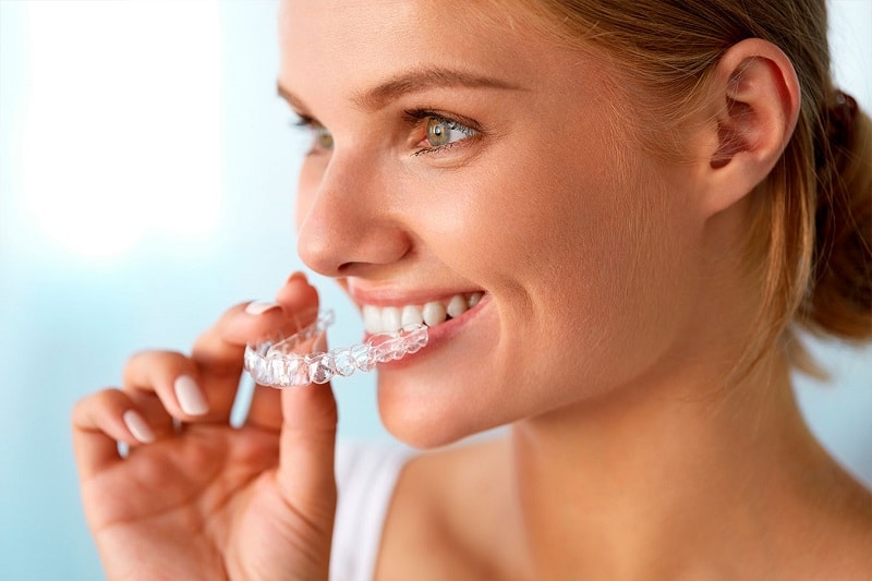 Купить индивидуальные накладные зубы | Цена накладных зубов Рувинирс | RUVENEERS